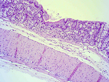 Moderate colitis (DSS administered, treated with Cyclosporin A), 100x