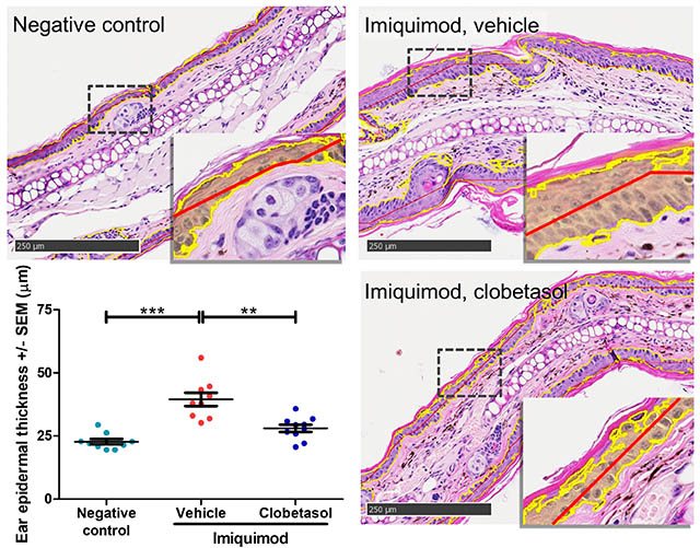 Epidermal thickening - H&E stained skin sections and calculated epidermal thickness)