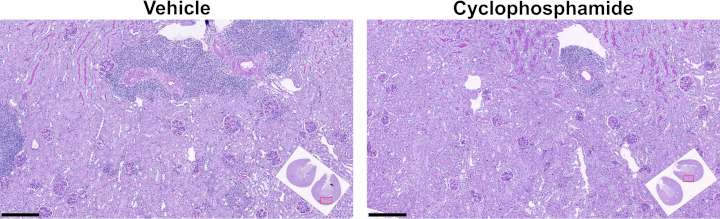 Illustrative images of Periodic acid-Schiff staining in kidneys