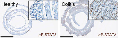 SCID colitis IHC anti-phospho-STAT